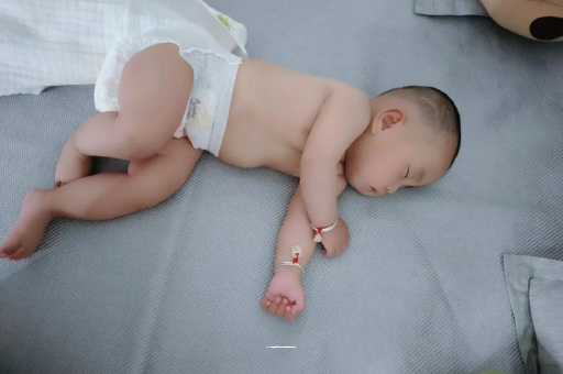 林州六个月宝宝眼睛散光